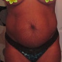 front view before surgery