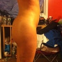 3 weeks post op