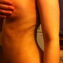 lumpiness in the dorsal roll area hope it smooths out over time (only place I've been lumpy so far)