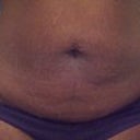 Before, front