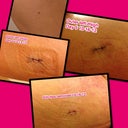 Outside left thigh