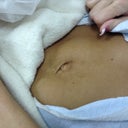 Pre op