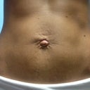 My whole stomach is messed up