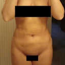 2 Weeks - Front