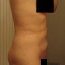 2 Weeks - Left