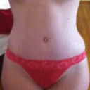 4 weeks PO. Feeling and looking great!