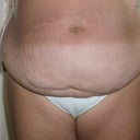 befor front