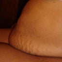 Day before surgery.  Side view sitting down.My belly is on my lap!!! I hate it!!!!
