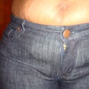 Day before surgery. What I look like in my jeans.  Frontal view.