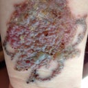 3 days after 4th session
