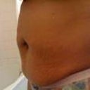 Pre- Surgery pic of my fat rolls