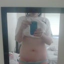 Before/ Front