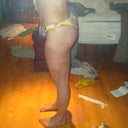 1 week post op