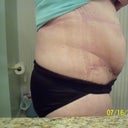 4 weeks PO