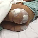 Day of surgery