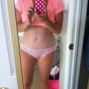 4.5 months post op