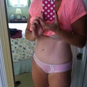 4.5 months post op