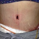 Belly button