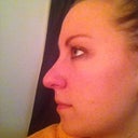 Before. Side view. Downward facing tip