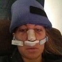 Day two. Icing my head.