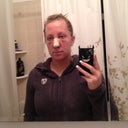 Day two. My forehead and cheeks are so swollen