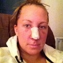 Day three. Still swollen