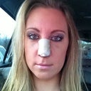 Day five. Out and about. Was able to put on makeup very gently. Swelling is down a lot, still bruised a little.