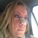 Day Seven. On my way to have brace taken off
