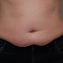tummy pooch