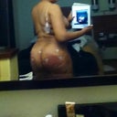 1 day post op