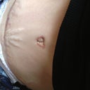 Almost 6 weeks PO my bb and stretch marks:(