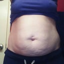 Before. Front view. A little bloated due to the fact that I am on my period