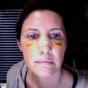 This was one week after surgery, no makeup AHHHH!
