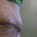 See the swelling