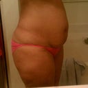 Pre op (39"W,48"H)