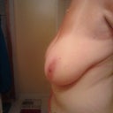 Side Before 36DDD/E/F)??