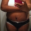 PO Day 18....2 1/2 weeks and the swelling is starting to subside.