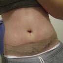 3 DPO - numb and swollen. looking thin from losing about 8lbs already.