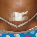 No more Drains and SWOLLEN.. arrrggghhh