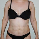 2 weeks (front)