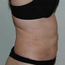 2 weeks (right)