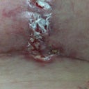underneath my breast