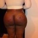 Back side After
