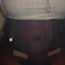 2 days post opt