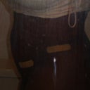 2 days post opt..look at the flanks