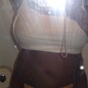 2 days post opt. still swollen