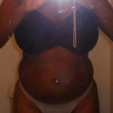 day before procedure front view