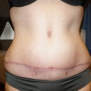Week 4 1/2 - looks the same to me...