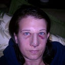 Looking rough! This was taken Wednesday, surgery was on Monday.