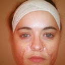 Post Op 10/09/12